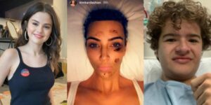 Celebridades que padecen duras enfermedades que pocos conocen - AlbertoNews