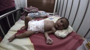 FAO y PMA advierten sobre aumento de desnutrición en Venezuela - Medio de comunicación para la comunidad de Habla Hispana