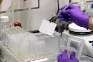 Habilitan laboratorio en Maiquetía para pruebas PCR