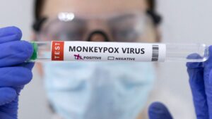 Piden reforzar la vigilancia de la viruela del mono en Venezuela