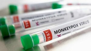 Suben a 21 los casos de viruela del mono en Estados Unidos