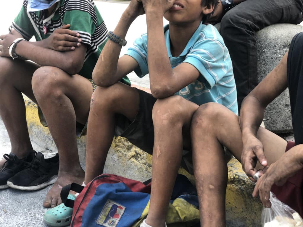 Califican de “doloroso” el hambre en los hogares venezolanos
