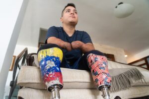 La historia del venezolano que perdió sus piernas y sus manos