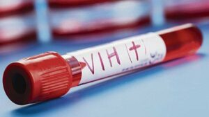 Más 6 mil personas se contagiaron de VIH en Venezuela en el 2021