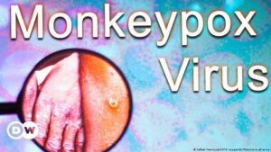 OMS confirma más de 5.000 casos de viruela del mono en el mundo | El Mundo | DW