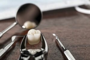 ▷ Gremio de Anzoátegui: En sector público la escasez de materiales e insumos para servicio de odontología es de casi 90% #26Jul