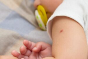 ▷ ¡Padres angustiados! Denuncian no conseguir la vacuna BCG en Lara #24Jul