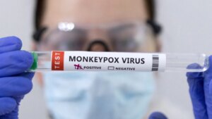 España combate el peor brote de viruela del mono de Europa
