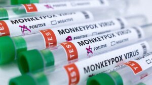 Perú reporta primera muerte relacionada a la viruela del mono: director de hospital
