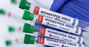 ¿De qué formas se contrae la viruela del mono?