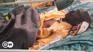 Diez muertos en dos ataques aéreos en la región rebelde de Tigré | El Mundo | DW