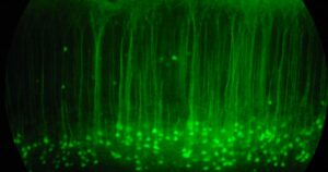Estudiar las neuronas de los ratones para comprender cómo funciona el cerebro humano | Actualidad