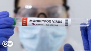 OMS cambia el nombre a la viruela del mono: ahora se llama mpox | El Mundo | DW