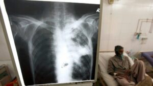 Crean consejo acelerador de vacunas contra la tuberculosis, anuncia la OMS en Davos