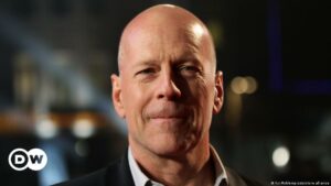 El actor Bruce Willis es diagnosticado con demencia frontotemporal | El Mundo | DW