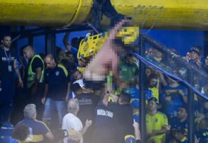 Fanático del Boca Juniors casi muere tras caer desde una tribuna del estadio la Bombonera y quedar atrapado en el alambrado de púas (+Imagen fuerte)
