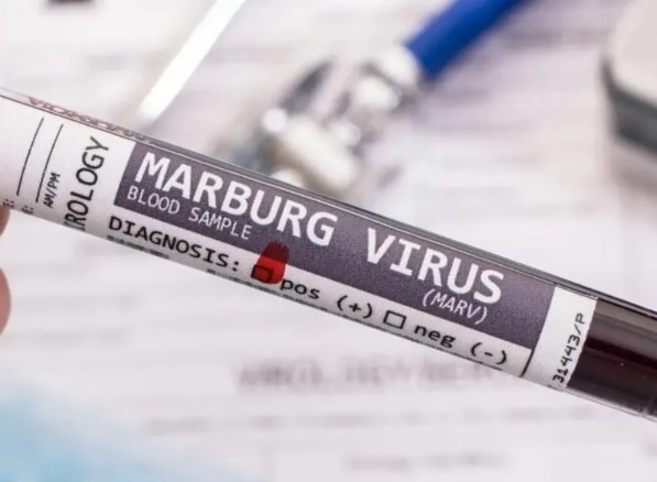 La OMS aseguró que avanzan los preparativos de ensayos de vacunas contra el virus de Marburgo