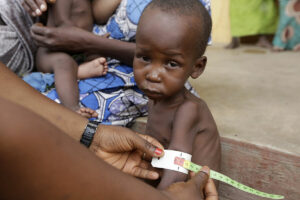 La ONU advierte sobre una "catstrofe de hambre" en Nigeria: dos millones de nios menores de 5 aos sin nada que comer