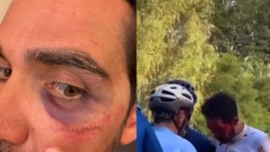 Alberto Contador sufre una aparatosa cada en el Desafo China de La Vuelta en Pekn: "Con puntitos y algn diente menos"