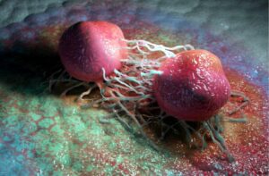 Nutrición de precisión: la estrategia para 'matar de hambre' a las células cancerosas