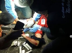 Dos lesionados dejó colisión de moto con carro en El Piñal