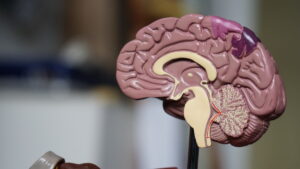 Estudio demuestra que región de la amígdala cerebral es clave en alzhéimer