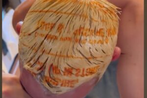 VIRAL: El terrible accidente de un estadounidense que intentó teñirse el cabello con bolsa de plástico (VIDEO)