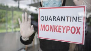 Hong Kong aumentó la vigilancia por aumento de caso de viruela del mono