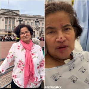 Mujer que se fue a vacaciones a Europa y adquirió bacteria tuvo que ser amputada - Santander - Colombia