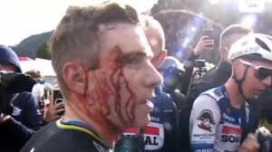 ciclista impactó contra una mujer al cruzar la meta y terminó con el rostro ensangrentado