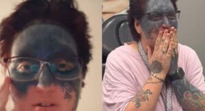 Ayuda le cambió la vida a mujer; eliminarán tatuaje indeseado en su cara