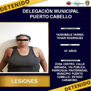 Dos mujeres casi matan una joven en Puerto Cabello