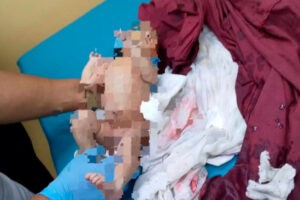 Hallan con vida a una bebé recién nacida en las orillas de una cañada en Maracaibo