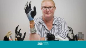 Una mano biónica conectada directamente a los nervios y huesos logra que una mujer vuelva a 'sentir'