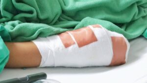 Quemados con pólvora: reporte de lesionados hasta el 10 de diciembre - Salud