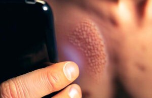 TELEVEN Tu Canal | Google Lens te ayuda a identificar afecciones en la piel