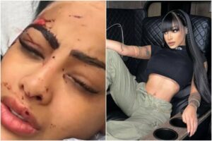 Una estilista venezolana reveló foto de Yailin La Más Viral con el rostro golpeado y en un hospital