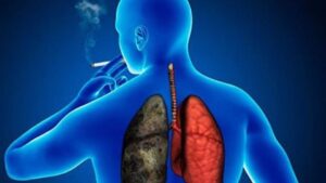 ¿Se puede entrenar el sistema inmunológico para prevenir el cáncer de pulmón? Esto dice la ciencia