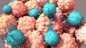 Es poco frecuente el desarrollo de un segundo cáncer tras la terapia con células CAR-T