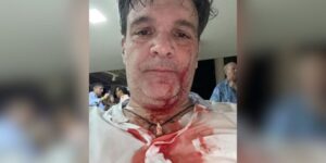 Ricardo Cusanno denunció agresión en una trifulca en la fiesta de Año Nuevo del Club Playa Azul
