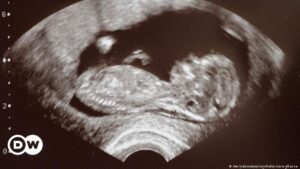 Así afecta tomar antidepresivos en el embarazo al feto – DW – 16/02/2024
