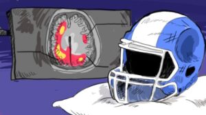 Investigación cuestiona los pagos de la NFL a jugadores víctimas de problemas cerebrales - AlbertoNews