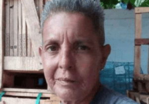 Murió mujer que fue atacada por 3 perros en Tanaguarena