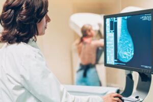 Sanidad espera la aprobación de un informe a finales de 2024 para ampliar el cribado de cáncer de mama desde los 45 años