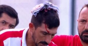 El insólito accidente que sufrió el entrenador de arqueros de Unión en el banco de suplentes durante el partido con Sarmiento