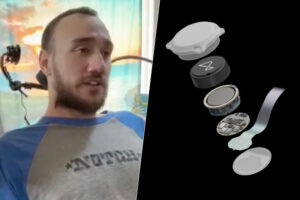 Elon Musk comparte un vídeo del primer paciente con un implante de Neuralink