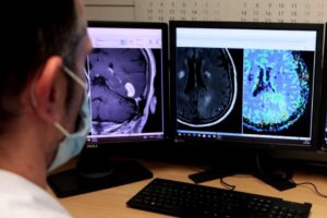 Herramienta basada en inteligencia artificial permitirá mejorar diagnóstico de tumores cerebrales