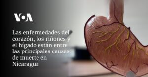Las enfermedades del corazón, los riñones y el hígado están entre las principales causas de muerte en Nicaragua en 2023