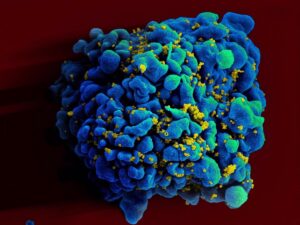 Un paso más cerca de una cura para el VIH