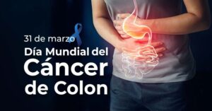 Alcanza a jóvenes el cáncer de colon